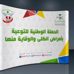 Popup Design 1